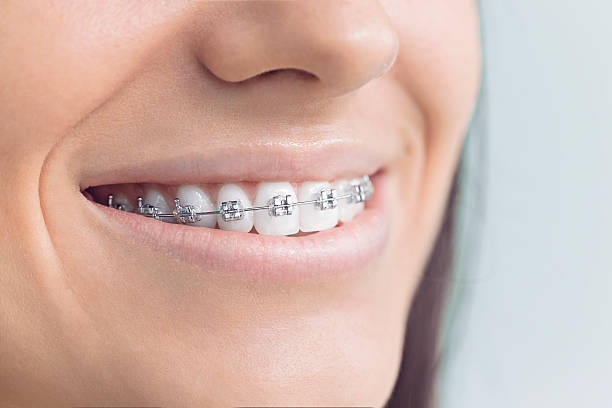 Best Traditional Braces  in Granville, OH